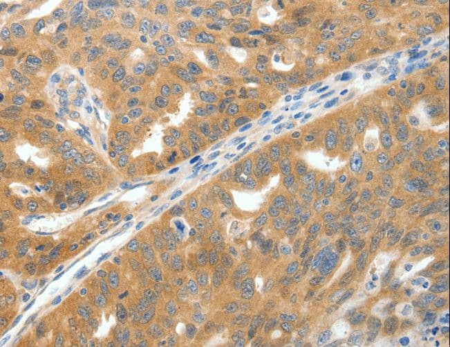 SCN9A / Nav1.7 Antibody