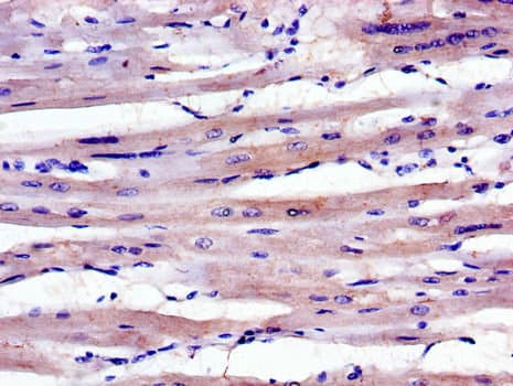 Polyclonal Rabbit anti-Human ABLIM1 Antibody (IHC, IF, WB)