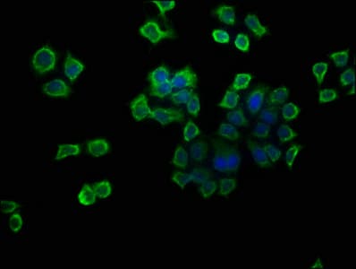 ATP6V1G1 / ATP6J Antibody