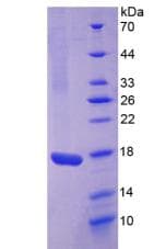 Rabbit IL17 Protein (Recombinant His)