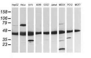 MAP2K1 / MKK1 / MEK1 Antibody (clone OTI1A10)