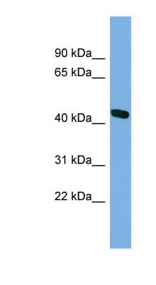 CAMK1D Antibody (aa287-336)