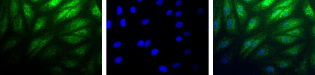 HIF2A / EPAS1 Antibody (C-Terminus, DY488)