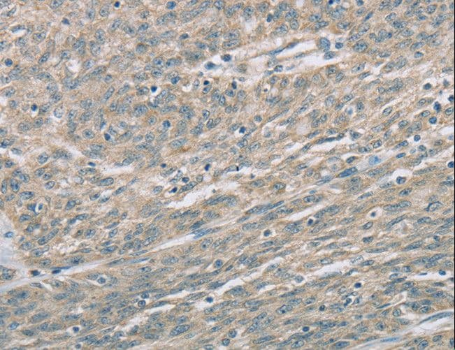 Polyclonal Rabbit anti-Human EDA2R / XEDAR Antibody (IHC, WB)
