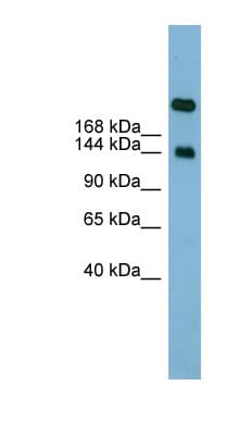 SI / Sucrase Isomaltase Antibody (aa1691-1740)