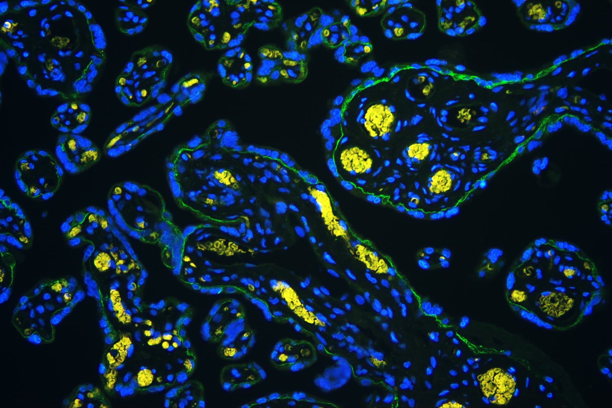 Polyclonal Rabbit anti-Human ITGA5/Integrin Alpha 5/CD49e Antibody (IHC, WB)