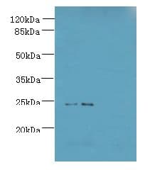 MED18 Antibody
