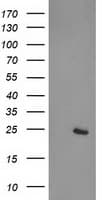 CDKN3 / KAP Antibody (clone OTI2H10)
