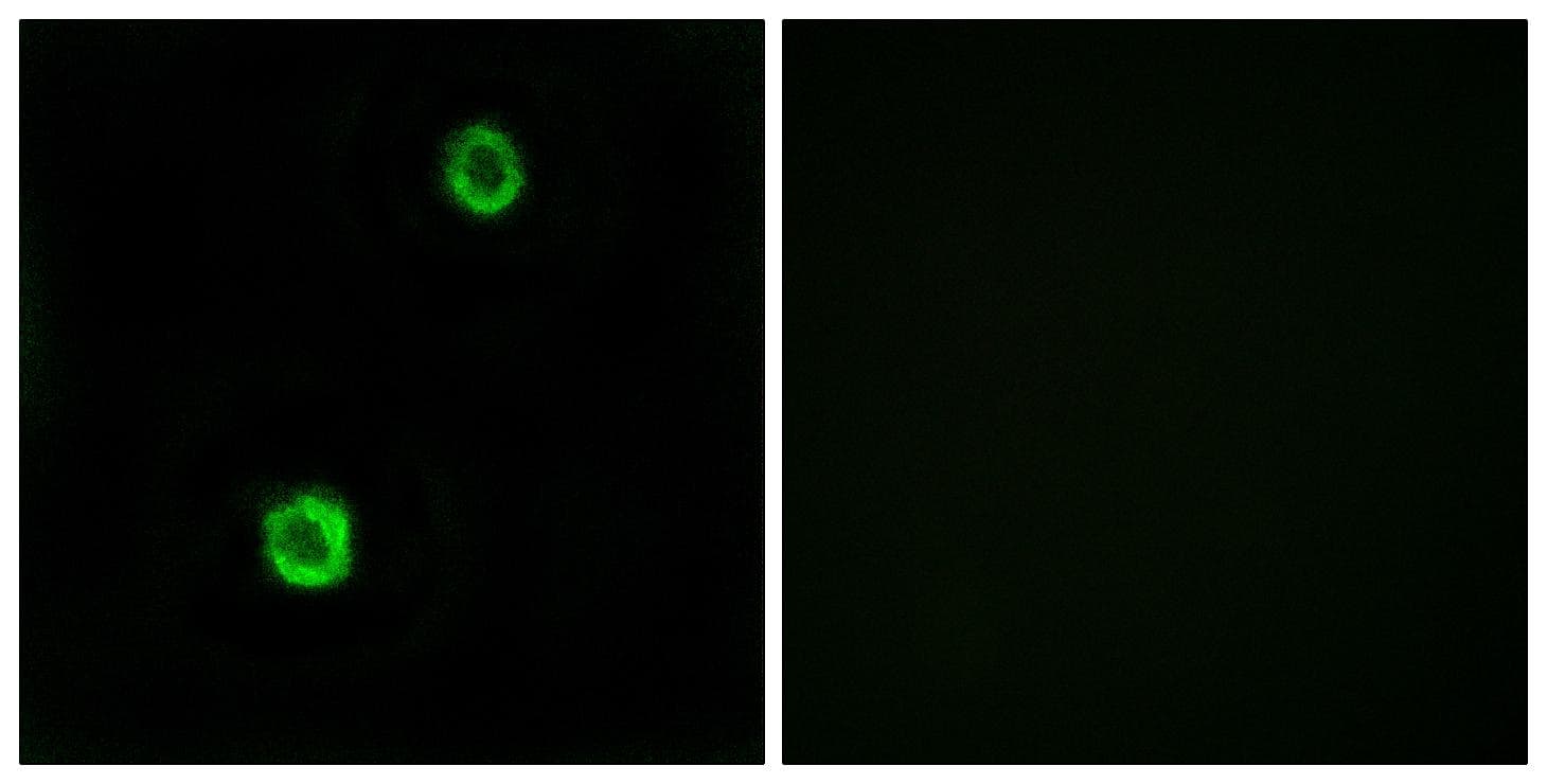 CST1 / Cystatin SN Antibody