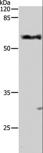 Polyclonal Rabbit anti-Human ALDH1A1 + ALDH1A2 + ALDH1A3 Antibody (IHC, WB)