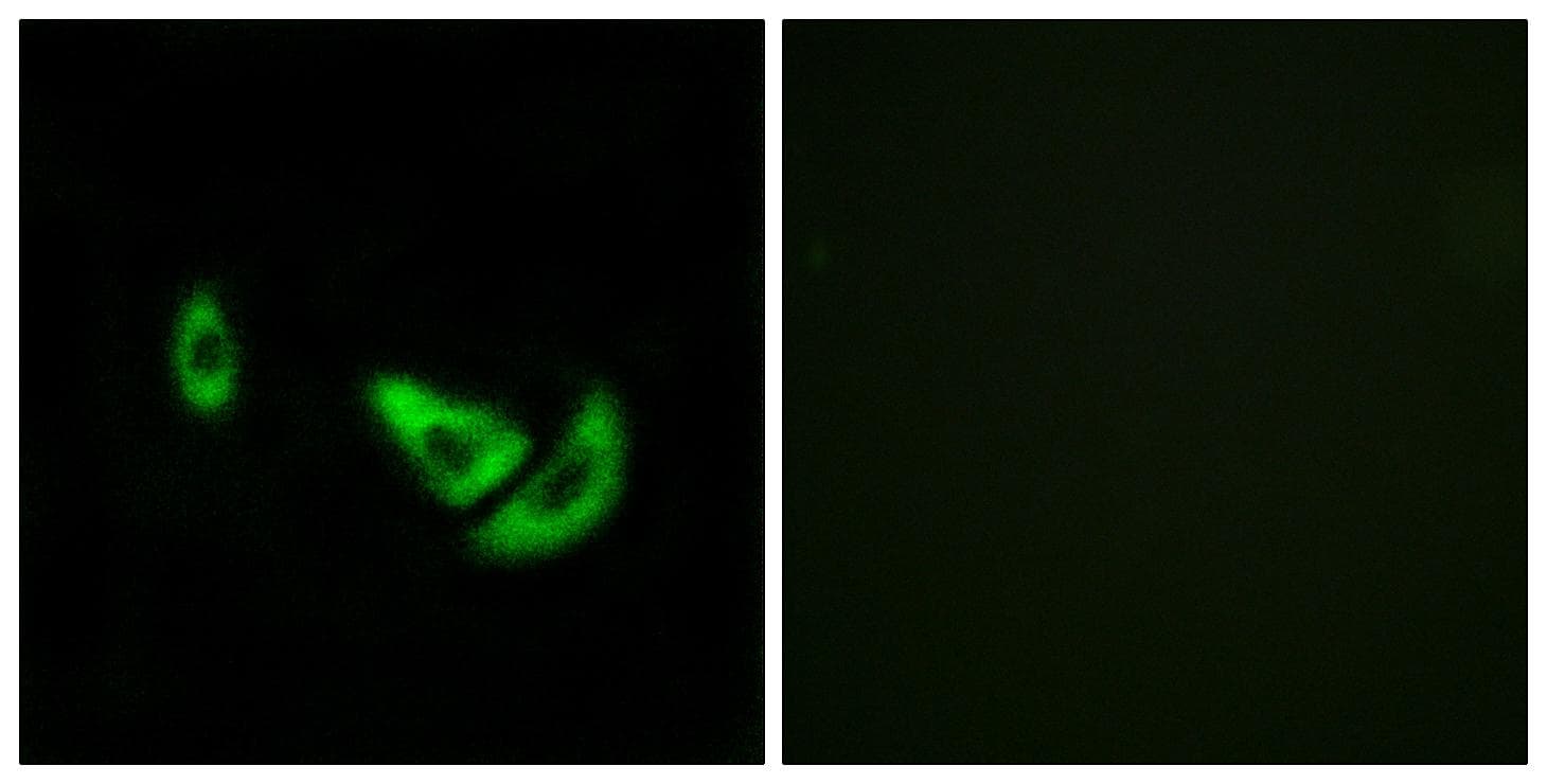DCT / Dopachrome Tautomerase Antibody