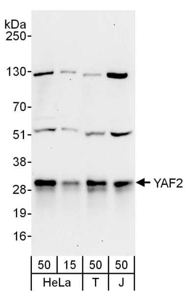 IHC-plus™ Polyclonal Rabbit anti-Human YAF2 Antibody (aa50-100, IHC, WB)
