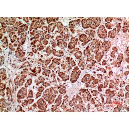 Polyclonal Rabbit anti-Human HPSE / Heparanase Antibody (241-290 aa, Internal, IHC, WB)