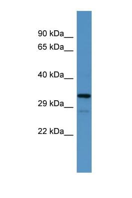HOXB1 Antibody (aa21-70)