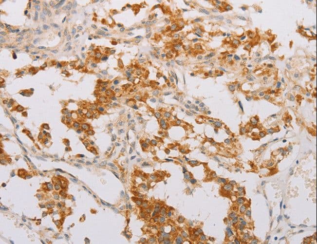 STK40 Antibody