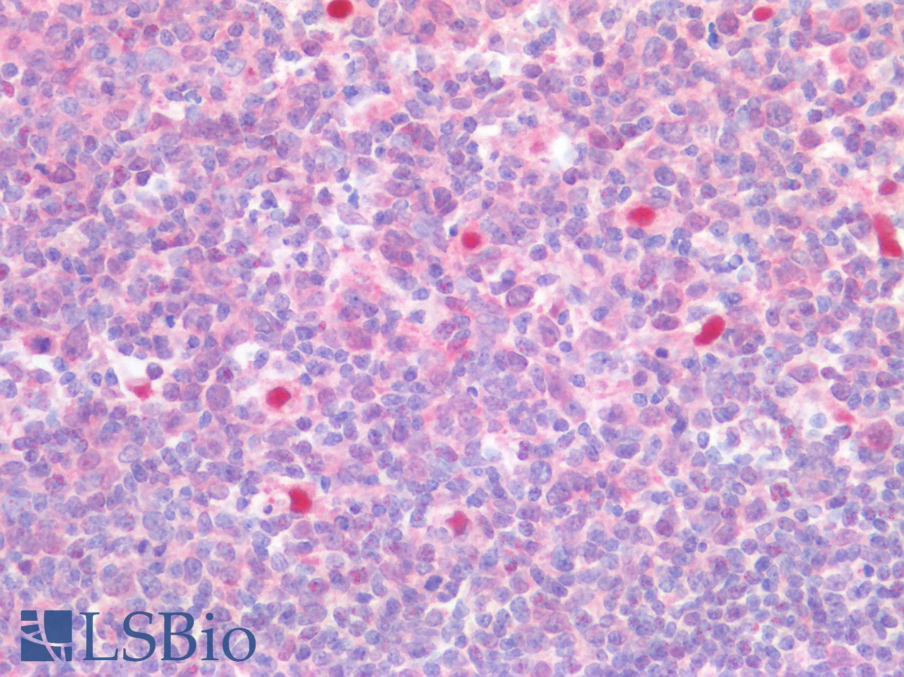 IHC-plus™ SQSTM1 Antibody