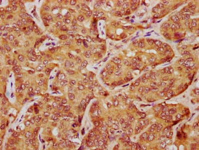 Polyclonal Rabbit anti-Human LATS1 Antibody (IHC, IF)