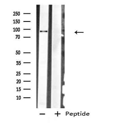 PLG / Plasmin / Plasminogen Antibody