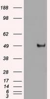 Monoclonal Mouse anti-Human MYC / c-Myc Antibody (clone OTI1A6, IHC, IF, WB)