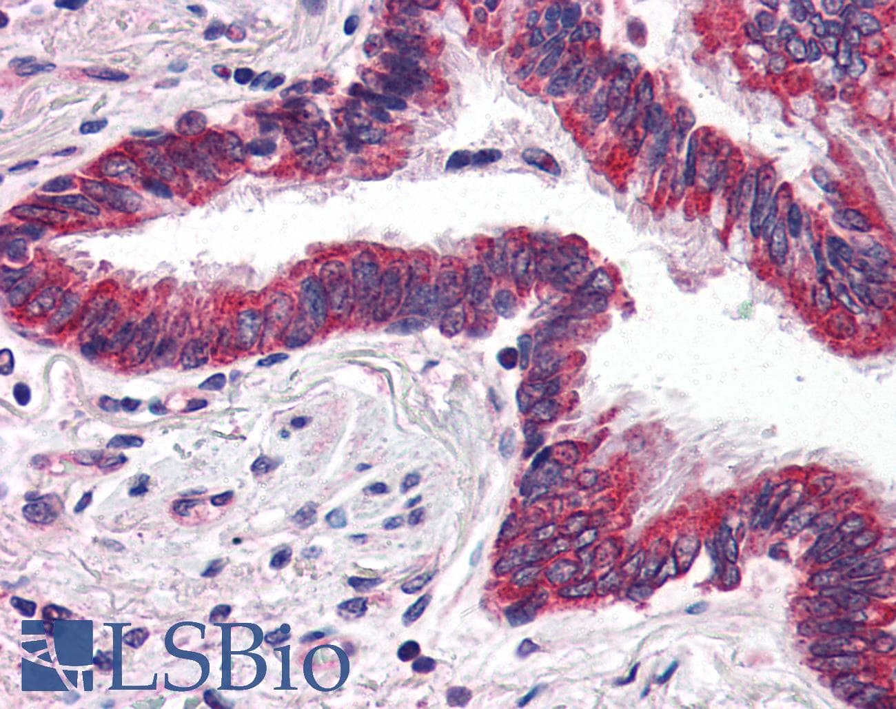 IHC-plus™ GRIK1 / GLUR5 Antibody