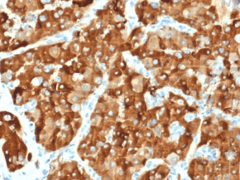 AMACR / P504S Antibody (clone AMACR/1864, Ready-to-Use)