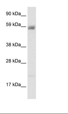Polyclonal Rabbit anti-Human ACCN3 / ASIC3 Antibody (aa53-102, IHC, WB)