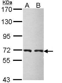Polyclonal Rabbit anti-Human CBS Antibody (aa39-251, IHC, WB)