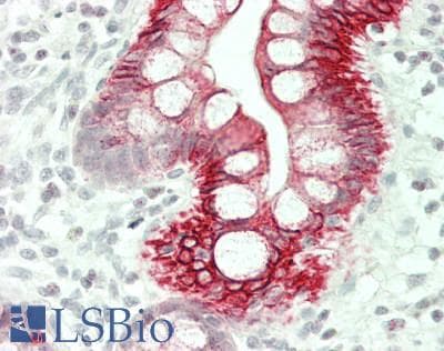 PathPlus™ Polyclonal Rabbit anti-Human KRT20 / CK20 / Cytokeratin 20 Antibody (IHC, WB)