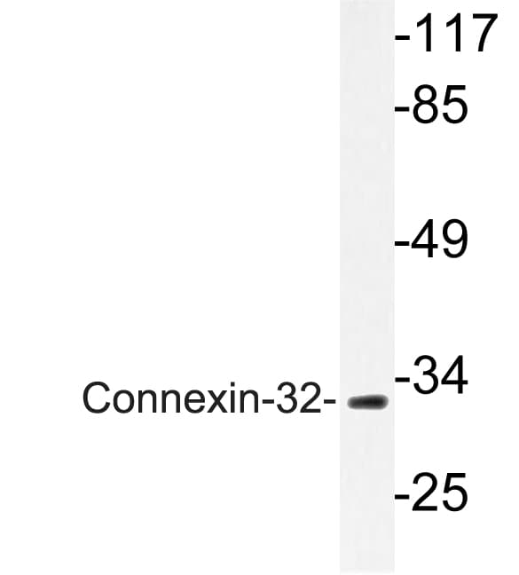 GJB1 / CX32 / Connexin 32 Antibody (Leu115)