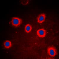 PathPlus™ KRT8 / CK8 / Cytokeratin 8 Antibody (Internal)