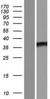 Human SOWAHD / ANKRD58 Protein (Over-Expression Lysate Myc-DDK (Flag))