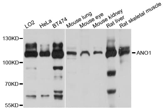 Polyclonal Rabbit anti-Human ANO1 / DOG1 / TMEM16A Antibody (WB)