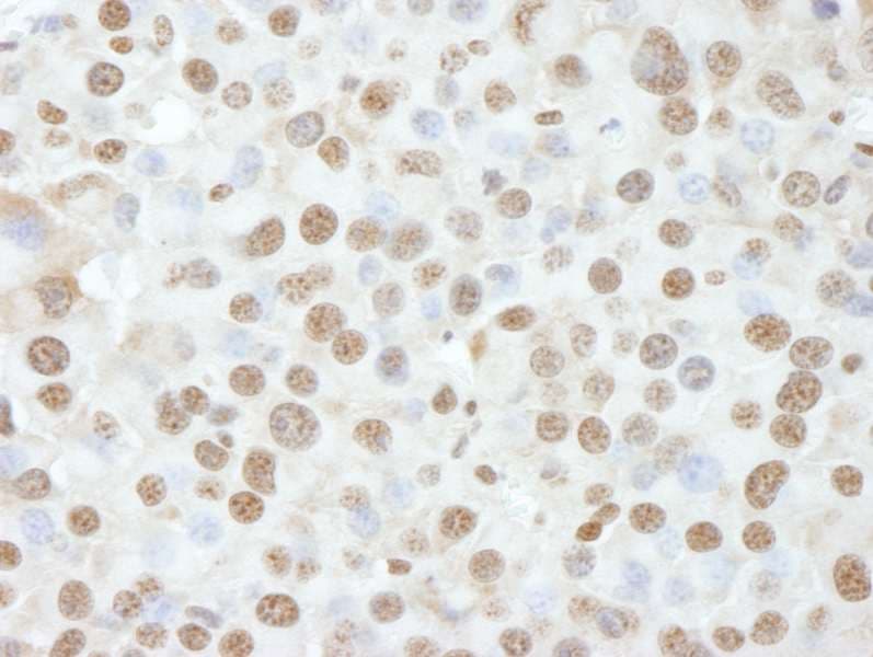 Polyclonal Rabbit anti-Human NUCKS1 Antibody (aa1-50, IHC, IF)