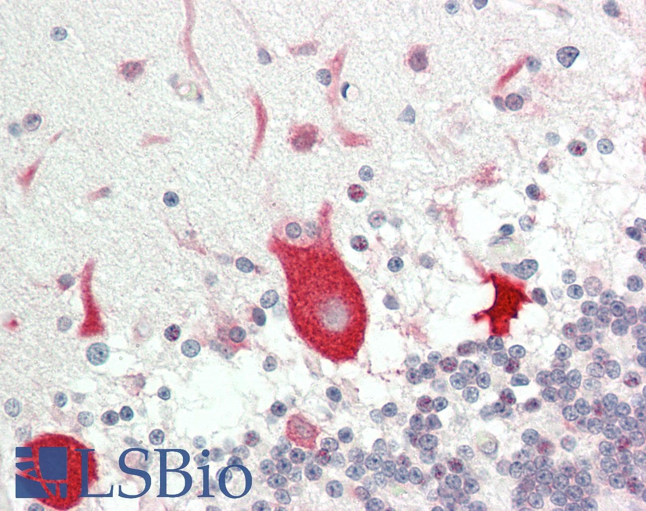 IHC-plus™ EF1G / EEF1G Antibody (aa200-250)