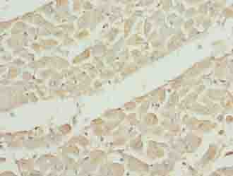 EPM2AIP1 Antibody