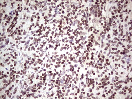 GLI4 Antibody (clone OTI3A9)