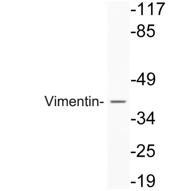 Vimentin Antibody (aa6-55)