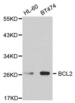 BCL2 / Bcl-2 Antibody