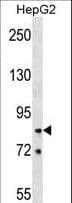 Polyclonal Rabbit anti-Human HNRNPR / hnRNP R Antibody (aa95-123, WB)