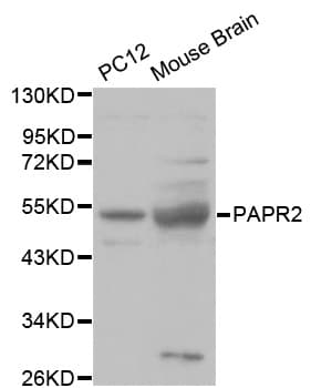 PathPlus™ PARK2 / Parkin 2 Antibody