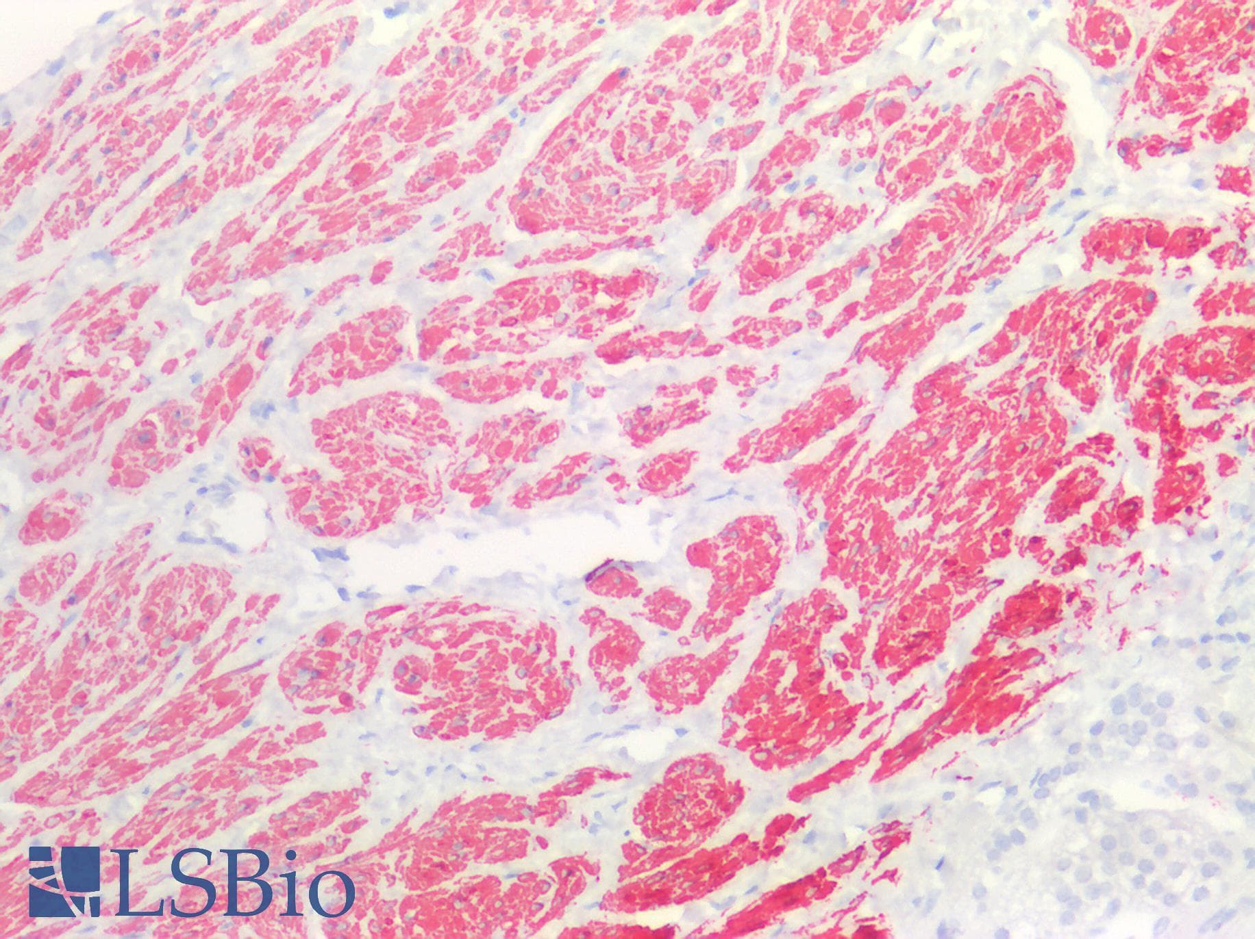 PathPlus™ ACTA2 / Smooth Muscle Actin Antibody (clone AT132D3)