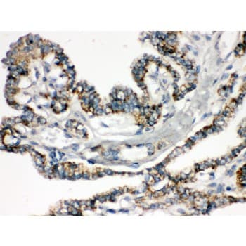 BIK Antibody (aa1-123)