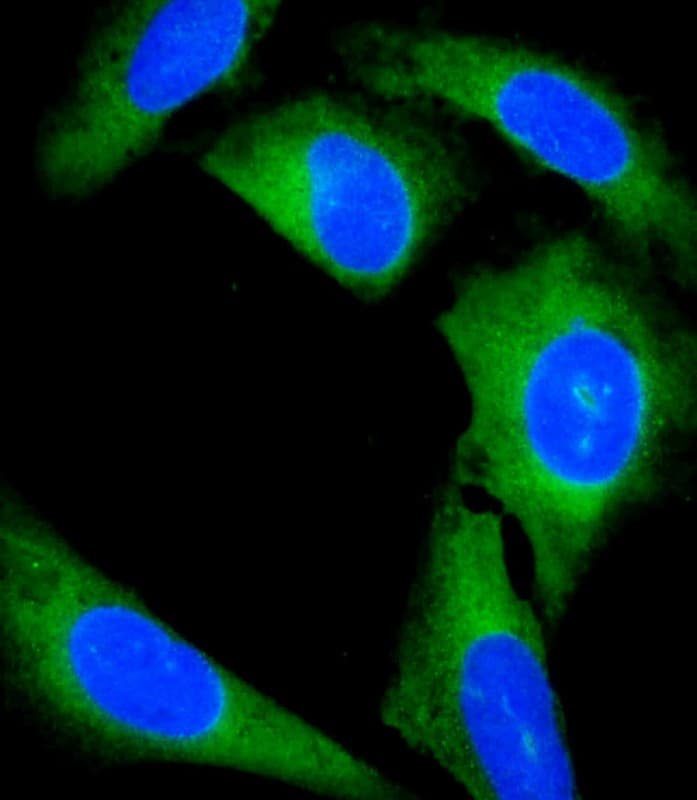 GCL / Grancalcin Antibody (N-Terminus)