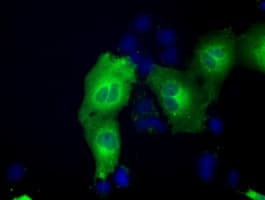 ACAT2 Antibody (clone OTI1B7)