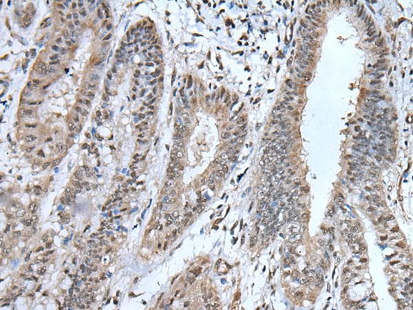 UBA52 Antibody