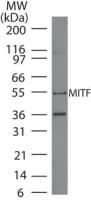 MITF Antibody (aa301-312, clone 21D1418)