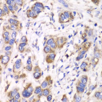 Polyclonal Rabbit anti-Human ALDH2 Antibody (IHC, IF, WB)