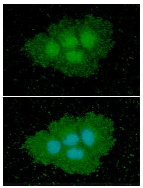 Monoclonal Mouse anti-Human ASS1 / ASS Antibody (clone AT1G11, WB)
