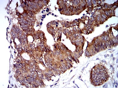 Monoclonal Mouse anti-Human TRIM25 Antibody (clone 5B5B12, IHC, IF, WB)