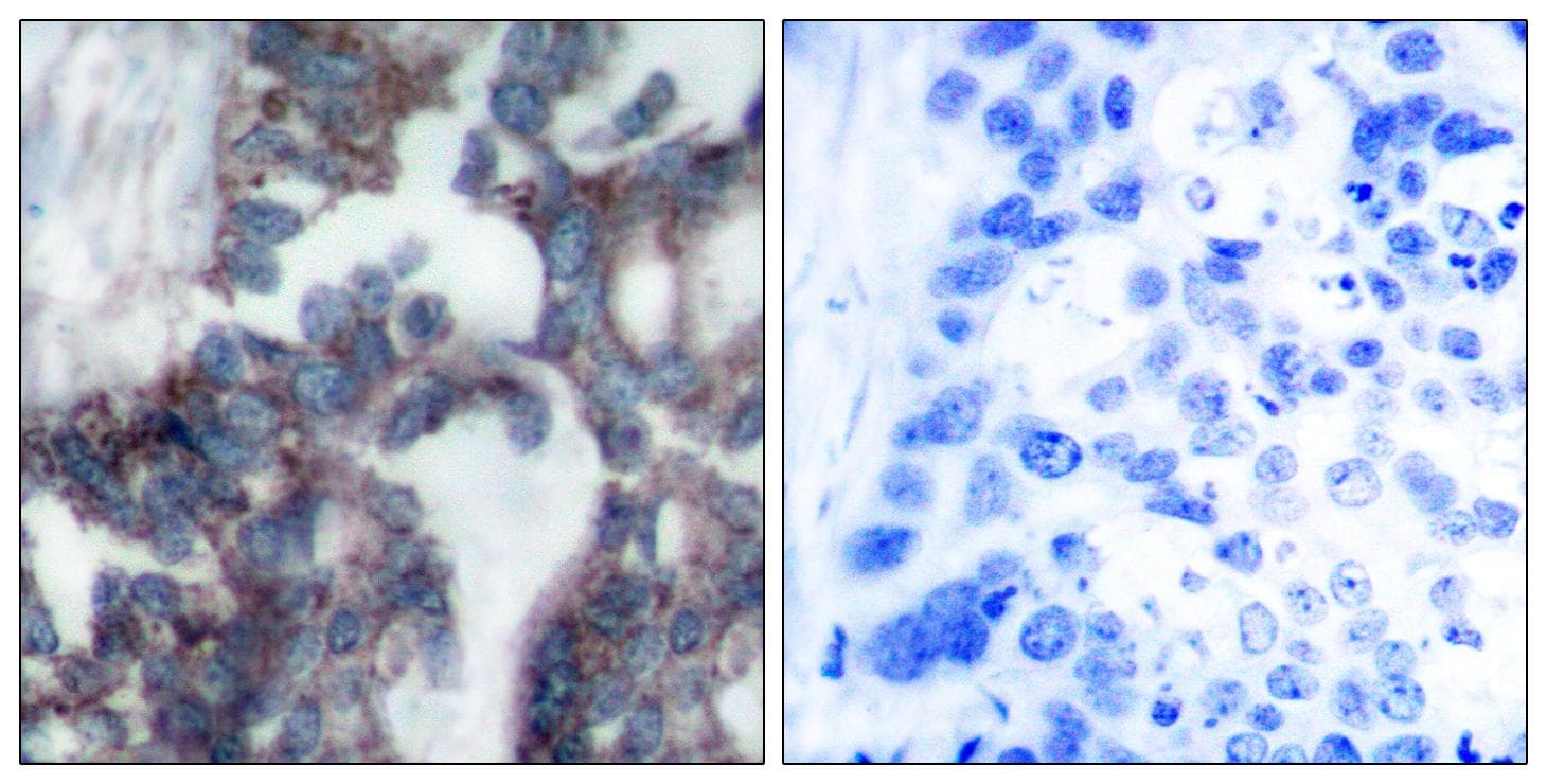 CLDN1 / Claudin 1 Antibody